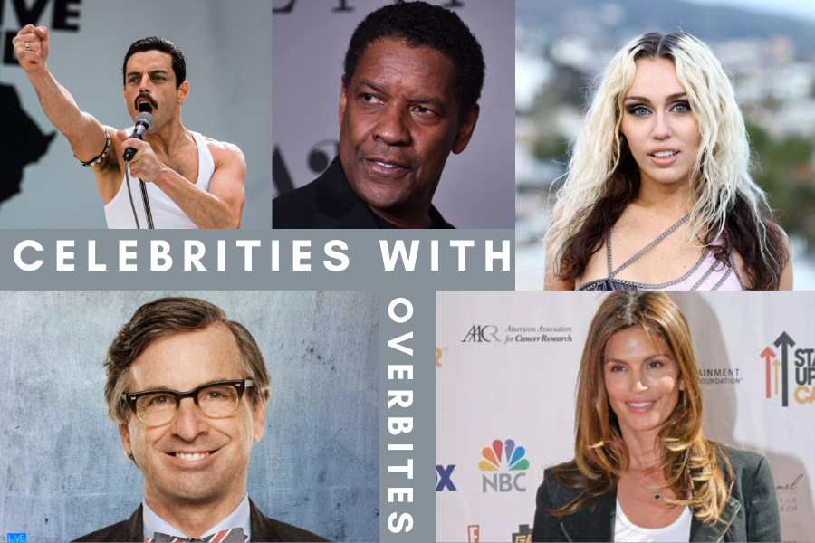 Celebrities with Overbites